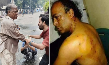 শিক্ষার্থীদের আন্দোলনে গিয়ে ফের আহত জবি শিক্ষক নাসির