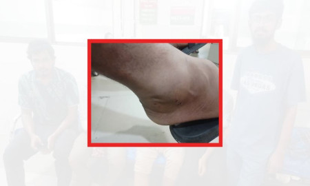 ঢাবিতে ঘুরতে এসে সাপের কামড়, হাসপাতালে ভর্তি হলেন জাহাঙ্গীরনগরের শিক্ষার্থী