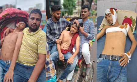 তিতুমীর কলেজে সিট বণ্টন নিয়ে ছাত্রদলের ২ গ্রুপের সংঘর্ষ, আহত ৫