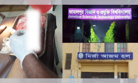 হাউজ টিউটরের গাফিলতিতে পঙ্গুত্বের শঙ্কায় জাবিপ্রবির শিক্ষার্থী