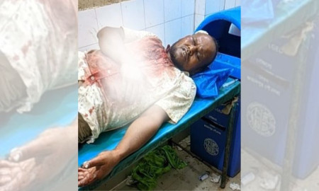 মাদকবিরোধী প্রতিবাদে হামলা, জামায়াত নেতাসহ আহত ১৩