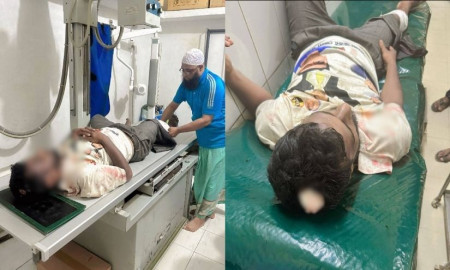 নেতাকে স্বাগত জানাতে গিয়ে বিএনপির দুই গ্রুপের সংঘর্ষ, আহত ৫ 