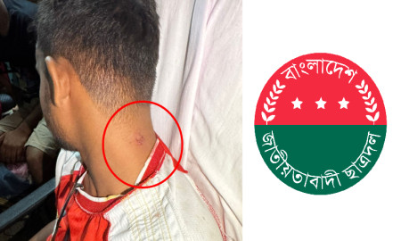 সংগঠনের এক নেতাকে কামড় দেওয়ার অভিযোগ ছাত্রদল নেতার বিরুদ্ধে