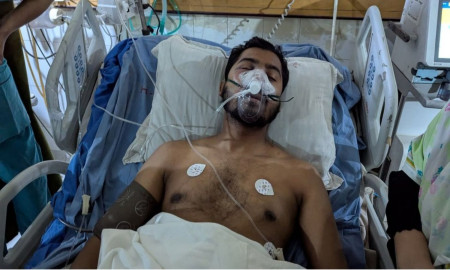 নাক ভেঙেছে নুরের, ক্ষতিগ্রস্ত চোয়াল — মেডিকেল বোর্ড গঠন