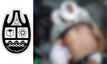 আইসিইউতে চবির নাইমুল, অবস্থা আশঙ্কাজনক