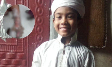  চুরির অপবাদ দিয়ে শিক্ষার্থীর হাত ঝলসে দেবার অভিযোগ শিক্ষকের বিরুদ্ধে