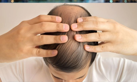 চুল পড়া বন্ধে ঘরোয়া ১০ উপায়