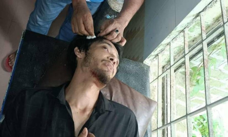 আবারও বহিরাগতদের হামলায় বাকৃবির দুই শিক্ষার্থী আহত