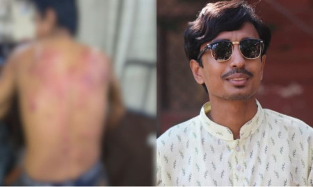 দুর্বৃত্তদের হামলায় আহত নজরুল কলেজ ছাত্র অধিকার পরিষদ নেতা নাহিদ 