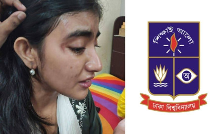 প্রাইভেট কার নিয়ে রিকশায় ছিনতাই— থেতলে গেল ঢাবি ছাত্রীর পা, মাথায় আঘাত