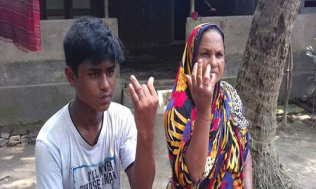 দেশে অ্যানথ্রাক্স বাড়ছে, সচেতন থাকতে হবে আপনাকেও