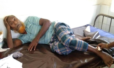 শিয়ালের কামড়ে ইউপি সদস্যসহ আহত ১০