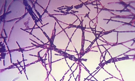 অ্যানথ্রাক্সে আক্রান্ত হয়ে সেই নারী মারা যাননি, ‌‘গুজব’ বলল জেলা স্বাস্থ্য বিভাগ