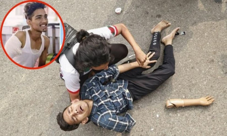 পুলিশের লাঠিপেটায় খুলে গেল জুলাইযোদ্ধা আতিকুলের কৃত্রিম হাত