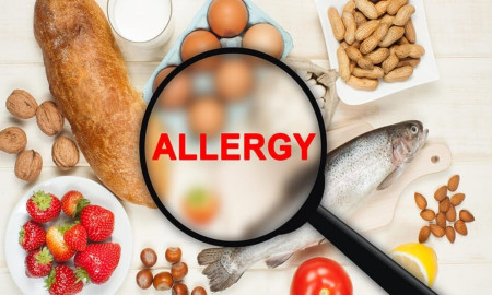 কারও দুধে অ্যালার্জি, কারও চিংড়িতে, কেন ‘ফুড অ্যালার্জি’ পরীক্ষা করানো খুব জরুরি?