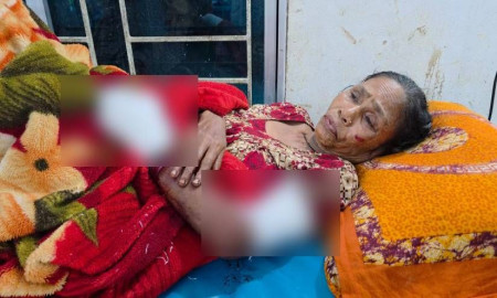 গোপালগঞ্জে ককটেল বিস্ফোরণে নারী আহত