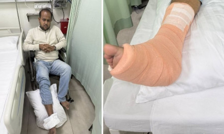 ভূমিকম্পে সিঁড়ি থেকে নামতে গিয়ে পা ভাঙল হামিমের