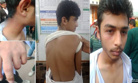 ফেসবুক পোস্ট ডিলেট না করায় সাতক্ষীরা বালক বিদ্যালয়ে জুনিয়র-সিনিয়র সংঘর্ষ, আহত ৩