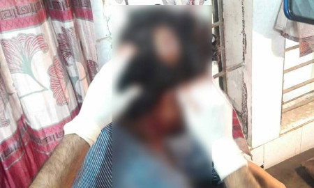 ইট দিয়ে সহকারী শিক্ষকের মাথা ফাটালেন যুবদল নেতা!