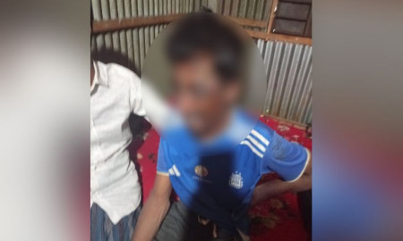 অচেতনভাবে পড়েছিলেন সাত দিন, জ্ঞান ফেরে কুকুর টেনে নিয়ে যাওয়ার সময়