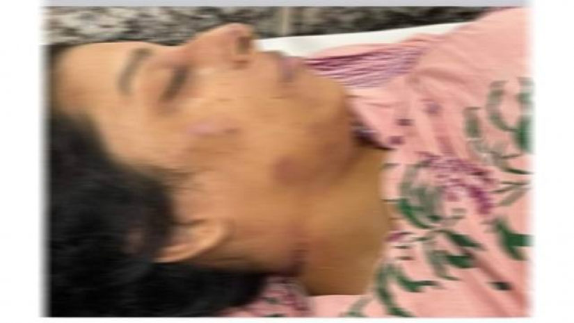 ঢাবি ছাত্রী মৃত্যুর ঘটনায় স্বামী আটক