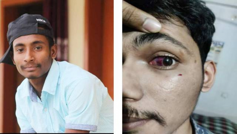 ‘তুমি’ সম্বোধনে ক্ষুব্ধ, কুবি ছাত্রকে মারধর-চোখে আঘাত ছাত্রলীগ নেতার