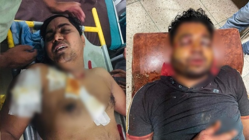 ১০ ঘন্টার সংঘর্ষে ঢাকা কলেজের তিন শতাধিক শিক্ষার্থী আহত