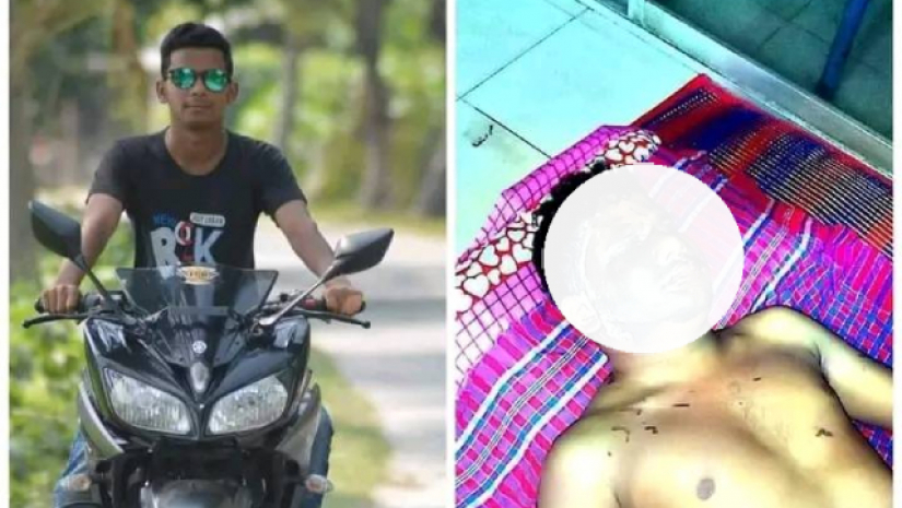 চবি ভর্তিচ্ছুকে এসিড মারলেন চাচা