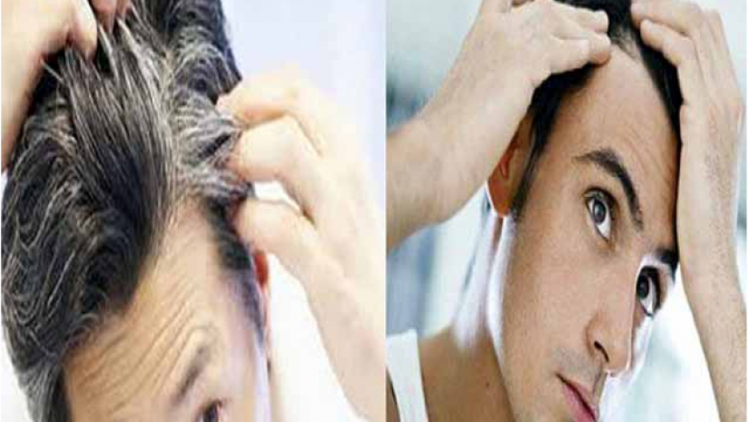 অল্প বয়সে চুল পাকা থেকে মুক্তি পেতে যে খাবারগুলো খাবেন