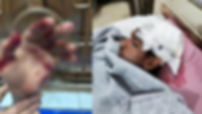 এবার শিক্ষাসফরে রক্তাক্ত জগন্নাথ বিশ্ববিদ্যালয় শিক্ষার্থীরা