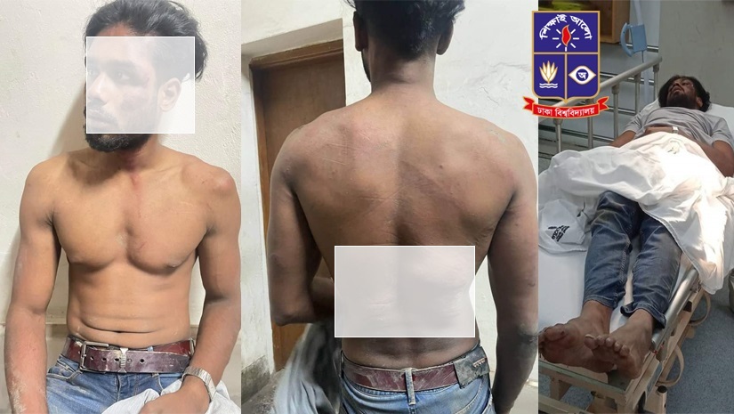 ঢাবি ছাত্রের নাকে-মুখে অনবরত স্টাম্পের আঘাত গ্যাংয়ের সদস্যদের
