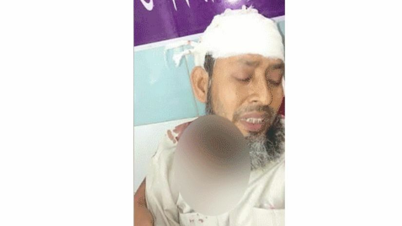 ছাত্রকে টিসি দেওয়ায় স্কুলের প্রধান শিক্ষককে কুপিয়ে জখম