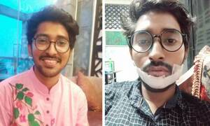 অস্ত্র ঠেকিয়ে ঢাবি শিক্ষার্থীর মোবাইল ছিনতাই, মুখে রামদার কোপ