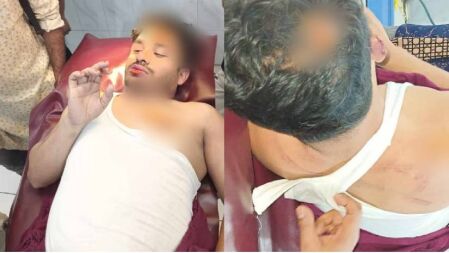 ছাত্রলীগের হামলায় গুরুতর আহত সাংবাদিক