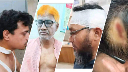 নিয়োগ অনিয়মের প্রতিবাদ করায় শিক্ষকদের পেটালেন সভাপতি-প্রধান শিক্ষক
