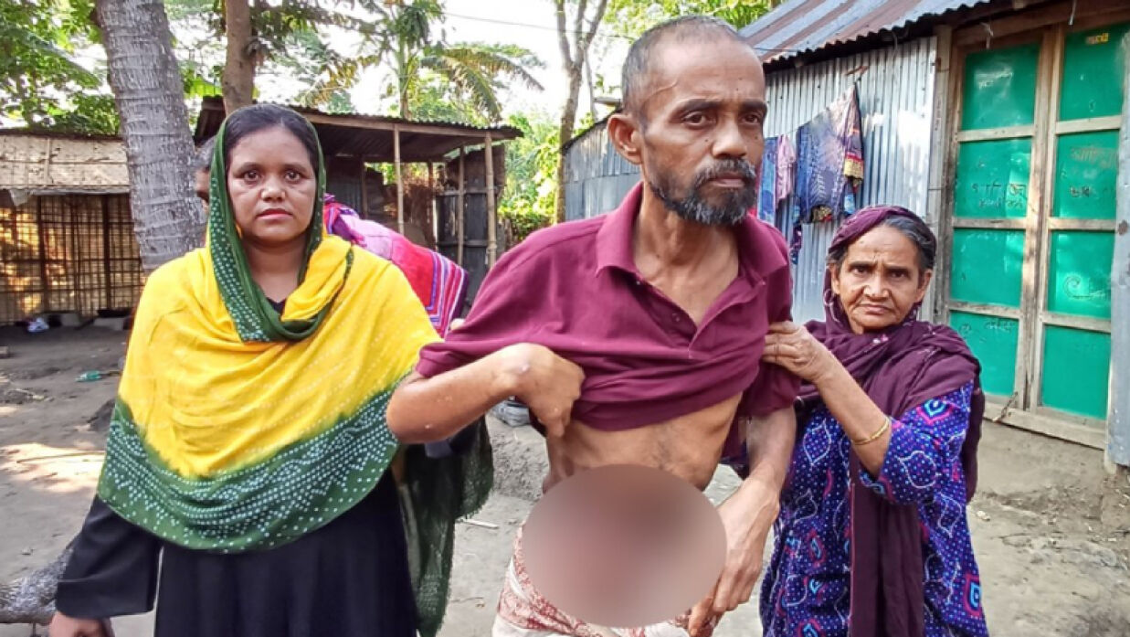 মিল্টনের আশ্রম থেকে উদ্ধার হওয়া সেলিমের কিডনি অক্ষত: চিকিৎসক