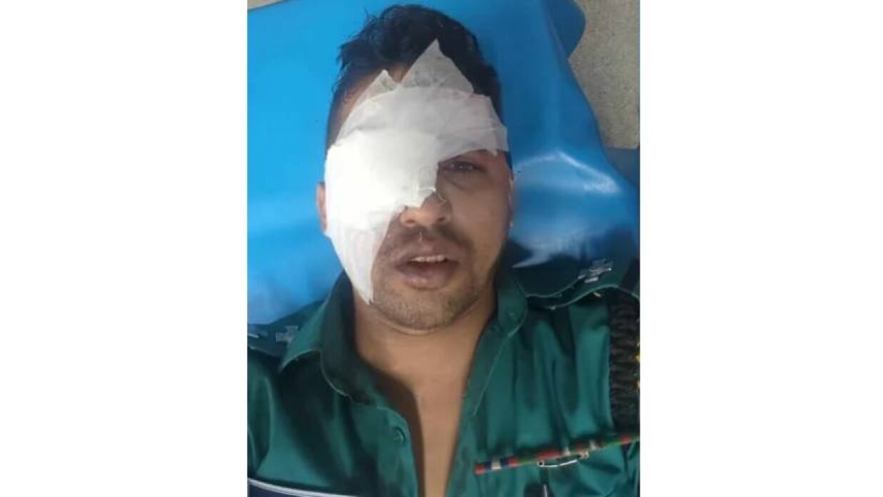 হিজড়াদের হামলায় চোখ হারালেন পুলিশের এসআই