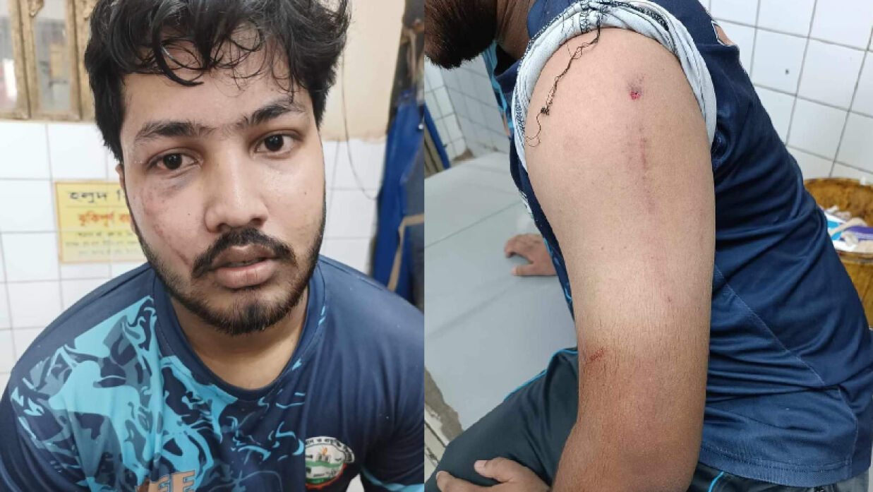 টিউশনির বকেয়া টাকা চাওয়ায় যবিপ্রবি শিক্ষার্থীদের মারধর, আহত ৫