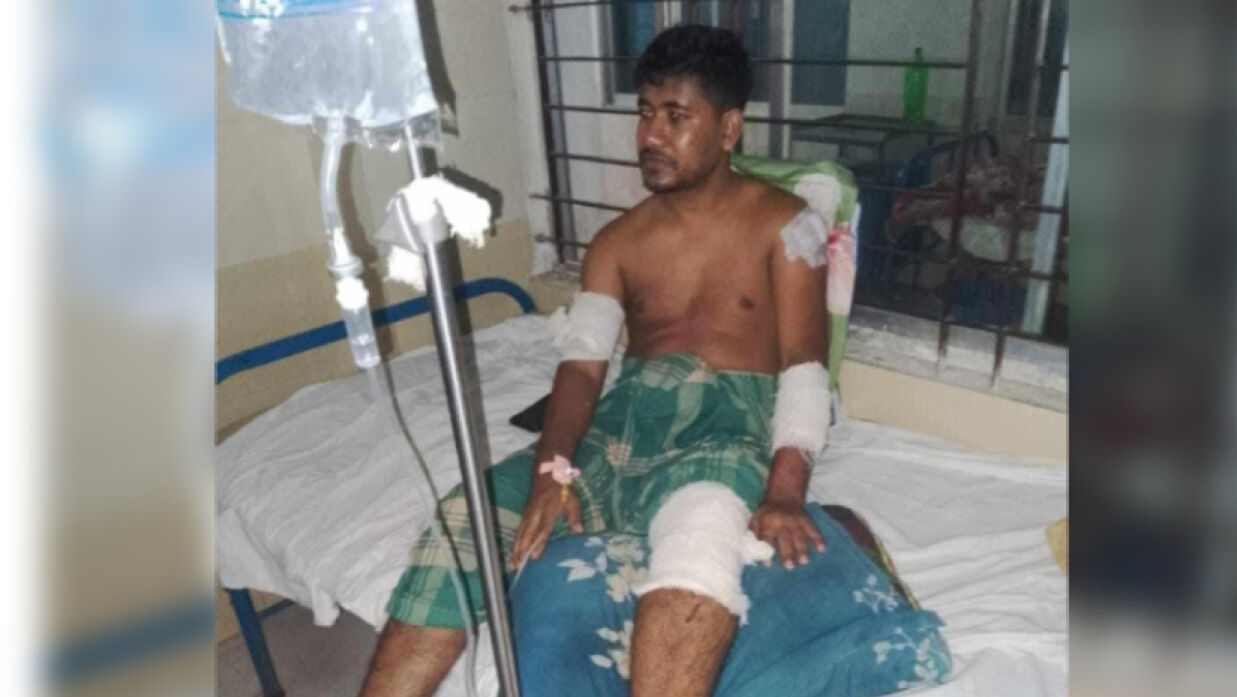 দুর্বৃত্তদের হামলায় ইসলামী বিশ্ববিদ্যালয় শিক্ষার্থী আহত