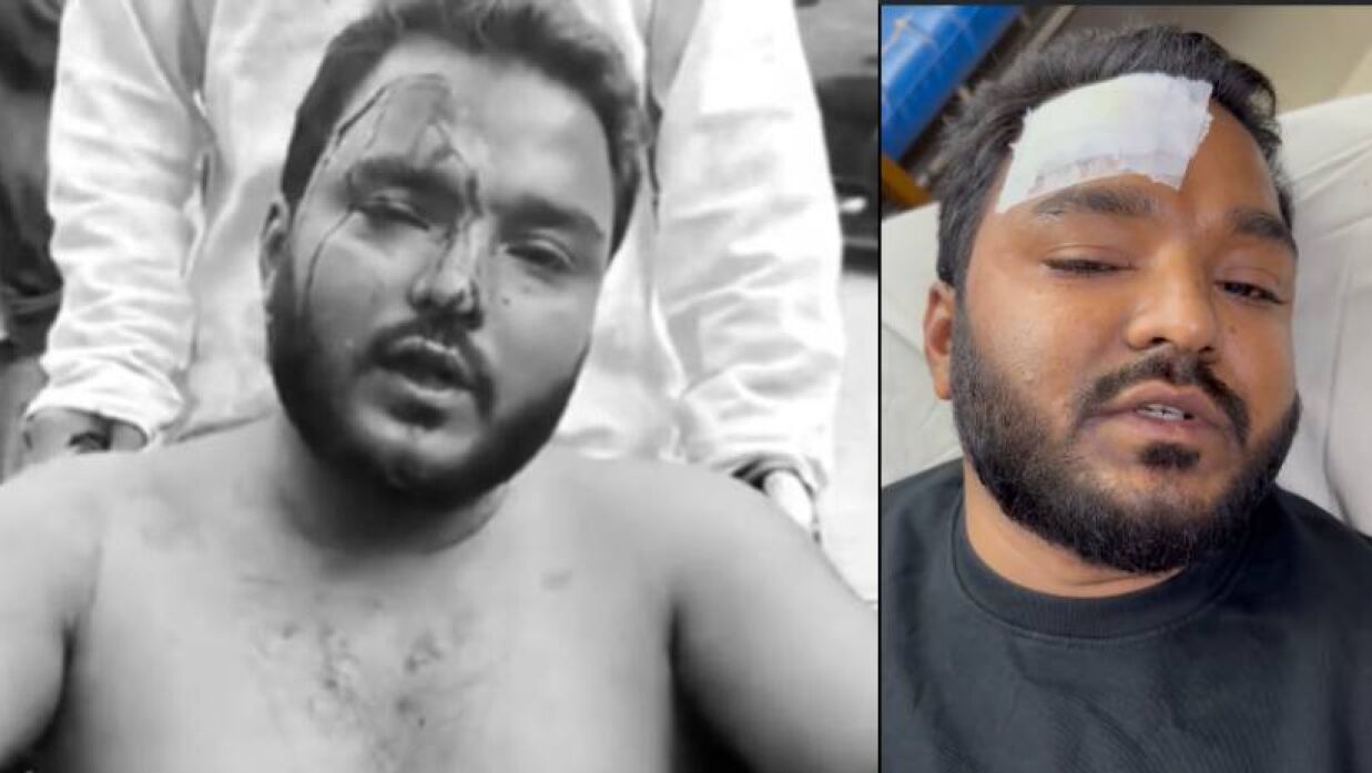 ছাত্রদল নয়, অন্য একটি সংগঠনের কর্মীরা হামলা করেছে: ভোল পাল্টালেন ফারুক