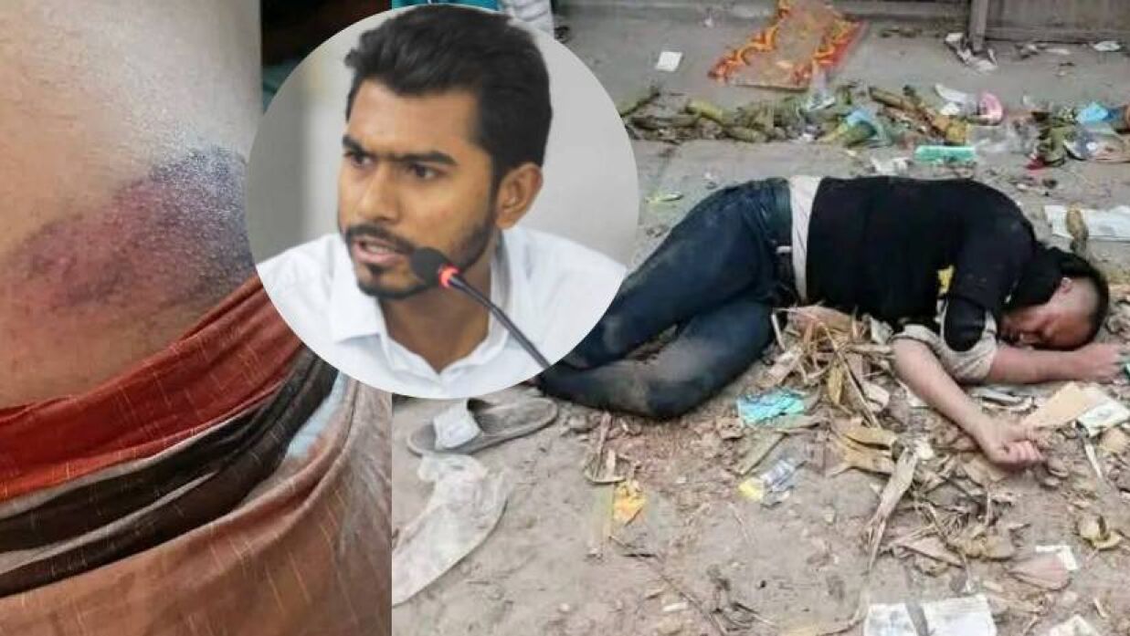 গণঅধিকারের কর্মীদের পিটিয়ে ‘ডাস্টবিনে’ ফেলার অভিযোগ যুবদল নেতাকর্মীদের বিরুদ্ধে