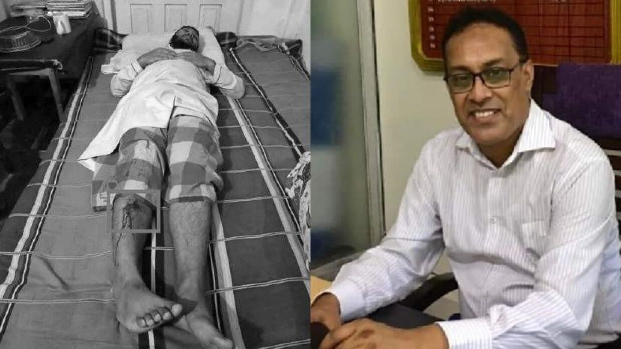 পায়ের রগ কাটার মত কোনো চিহ্ন পাওয়া যায়নি: চিকিৎসকের উদ্ধৃতি দিয়ে এমসি কলেজ অধ্যক্ষ