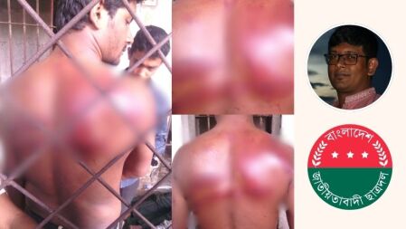 ঢাবির হলে ছাত্রদল নেতাকে তিন ঘণ্টা পেটায় ছাত্রলীগ, পুলিশে দেন প্রক্টর