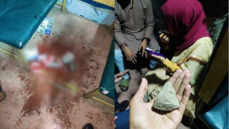 চট্টগ্রাম বিশ্ববিদ্যালয়ের শাটল ট্রেনে ছোড়া পাথরে জখম ছাত্রী