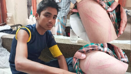 পারিবারিক দ্বন্দ্বের জেরে মাদ্রাসাছাত্রকে পিটিয়ে আহত করলেন শিক্ষক