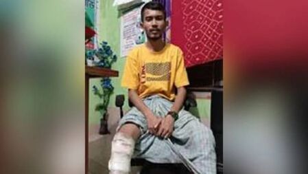 উন্নত চিকিৎসা না পেয়ে পঙ্গুত্বের শঙ্কায় দিন কাটছে বেল্লালের