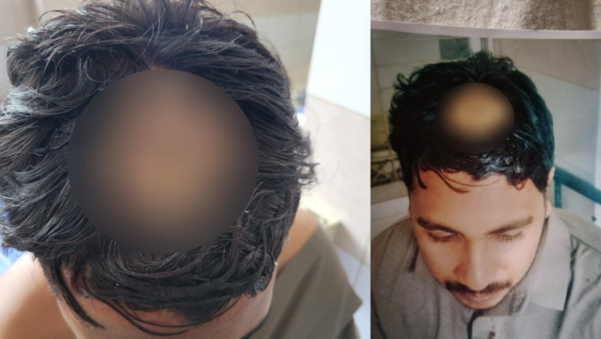 আহত মো. সাব্বির হোসেন