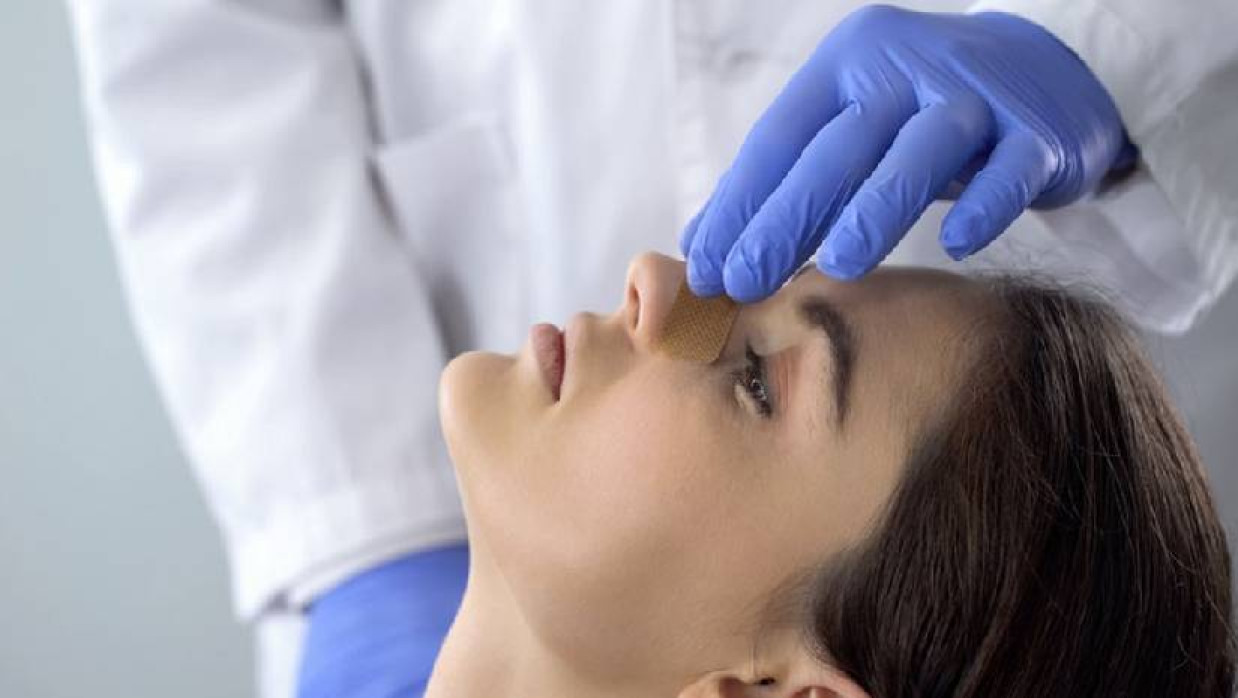 নাক দিয়ে রক্ত পড়া