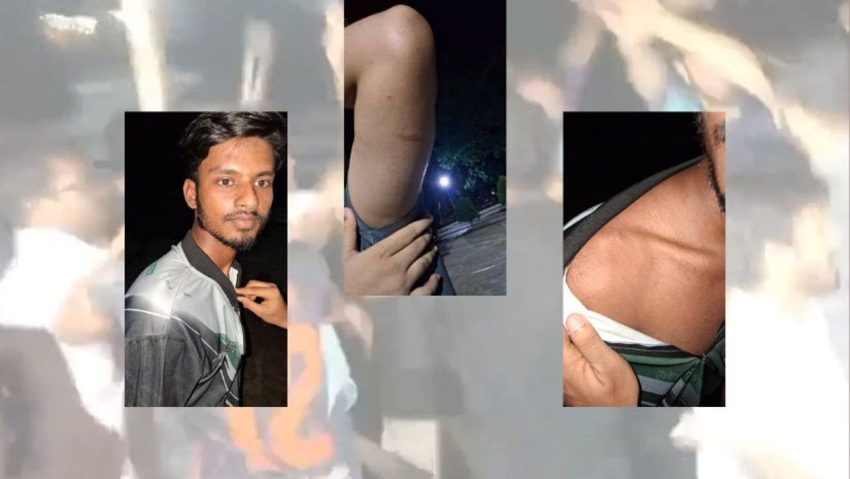 রাবিতে মারামারিতে আহত