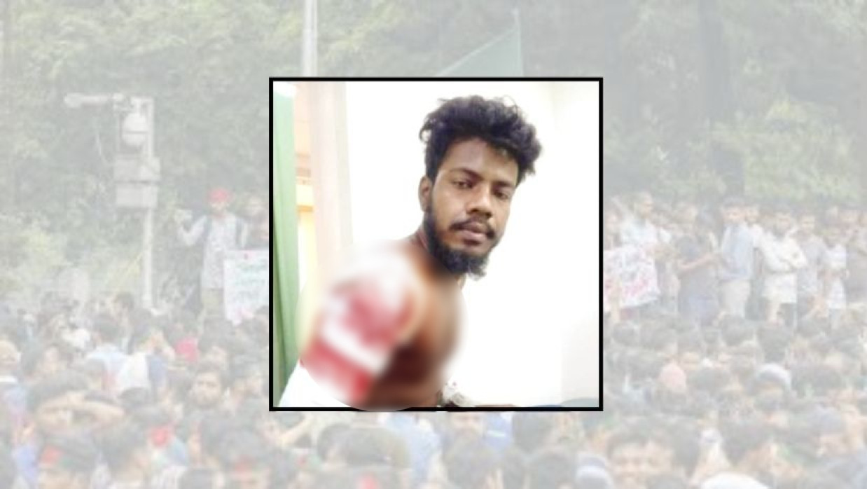 বৈষম্যবিরোধী ছাত্র আন্দোলনে গুলিতে আহত মোঃ আরিফুল ইসলাম রেজা